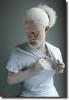 albino man