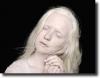 albino woman